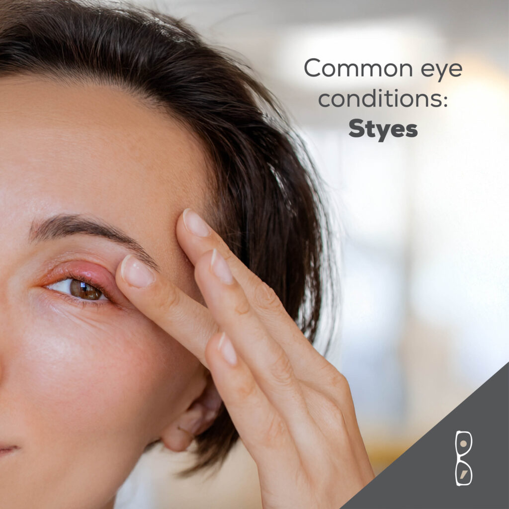 [object object] Is it a Stye? 4650 Socials Nov6 1024x1024 [object object] Blog 4650 Socials Nov6 1024x1024