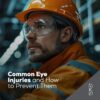 [object object] Common Eye Injuries and How to Prevent Them Linksfield Optom 14 100x100